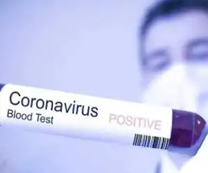 Waduh! Gegara Tes Swab COVID-19, Wanita Ini Alami Kebocoran Otak