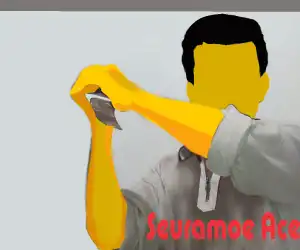 Tangan Harus di Operasi, RSUD Teuku Umar Diduga Lakukan Malpraktek
