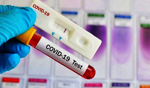 Hasil Test Swab, Seorang Santri Asal Bener Meriah Positif COVID-19