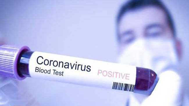 Waduh! Gegara Tes Swab COVID-19, Wanita Ini Alami Kebocoran Otak