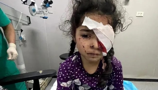 Miris! Akibat Genosida Israel, 1.500 Warga Gaza Mengalami Kebutaan
